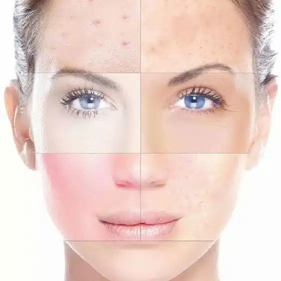dấu hiệu da lão hoá