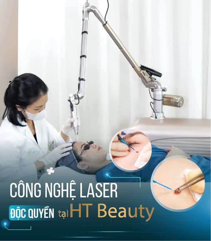 Tẩy nốt ruồi công nghệ Laser tại HT Beauty