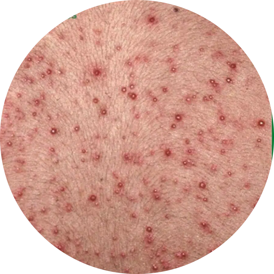 môi trường vi khuẩn