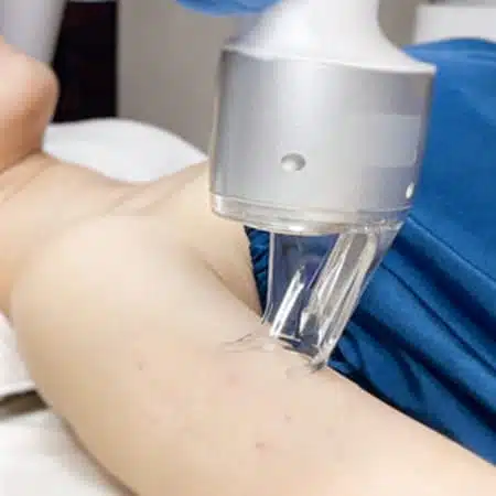 5 6 tuan 20230626014217 ck6 e