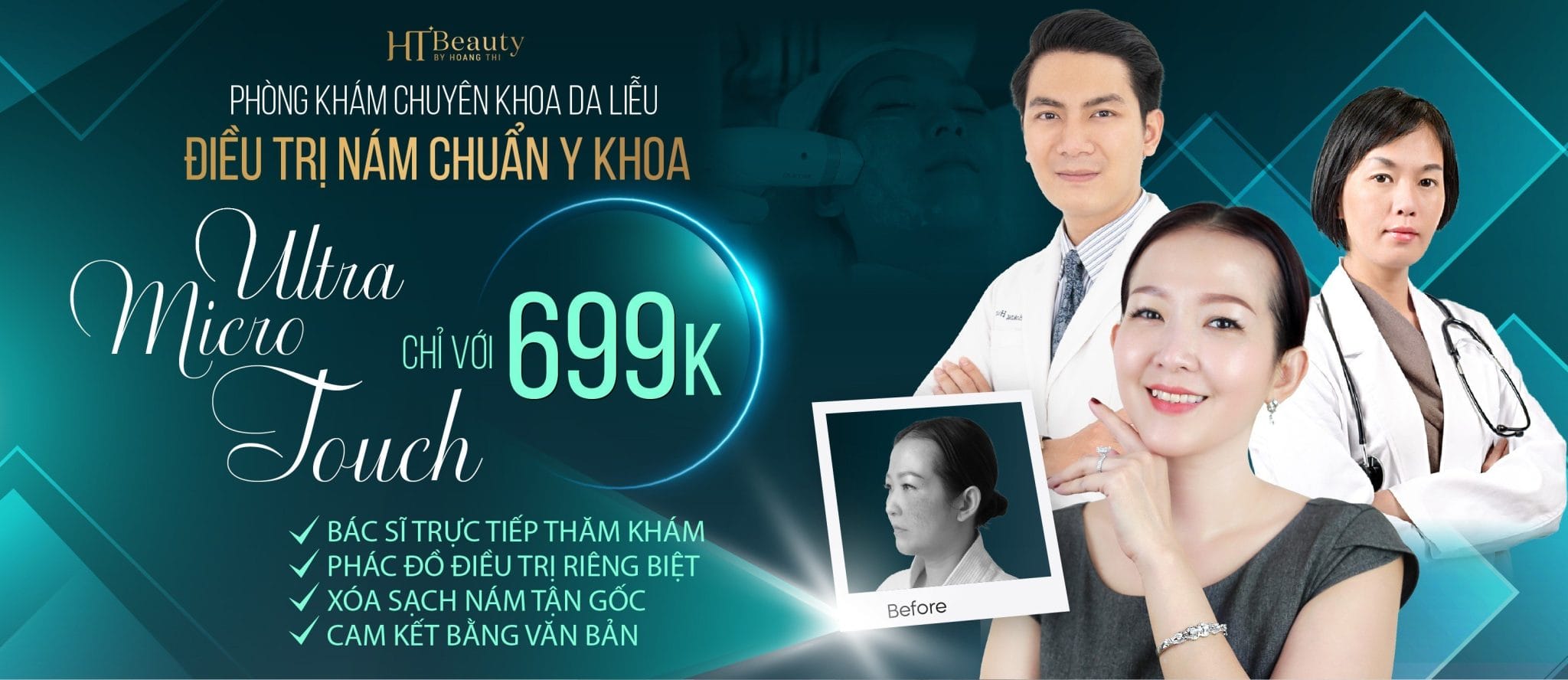 dieu-tri-nam-da-va-tan-nhang-hieu-qua