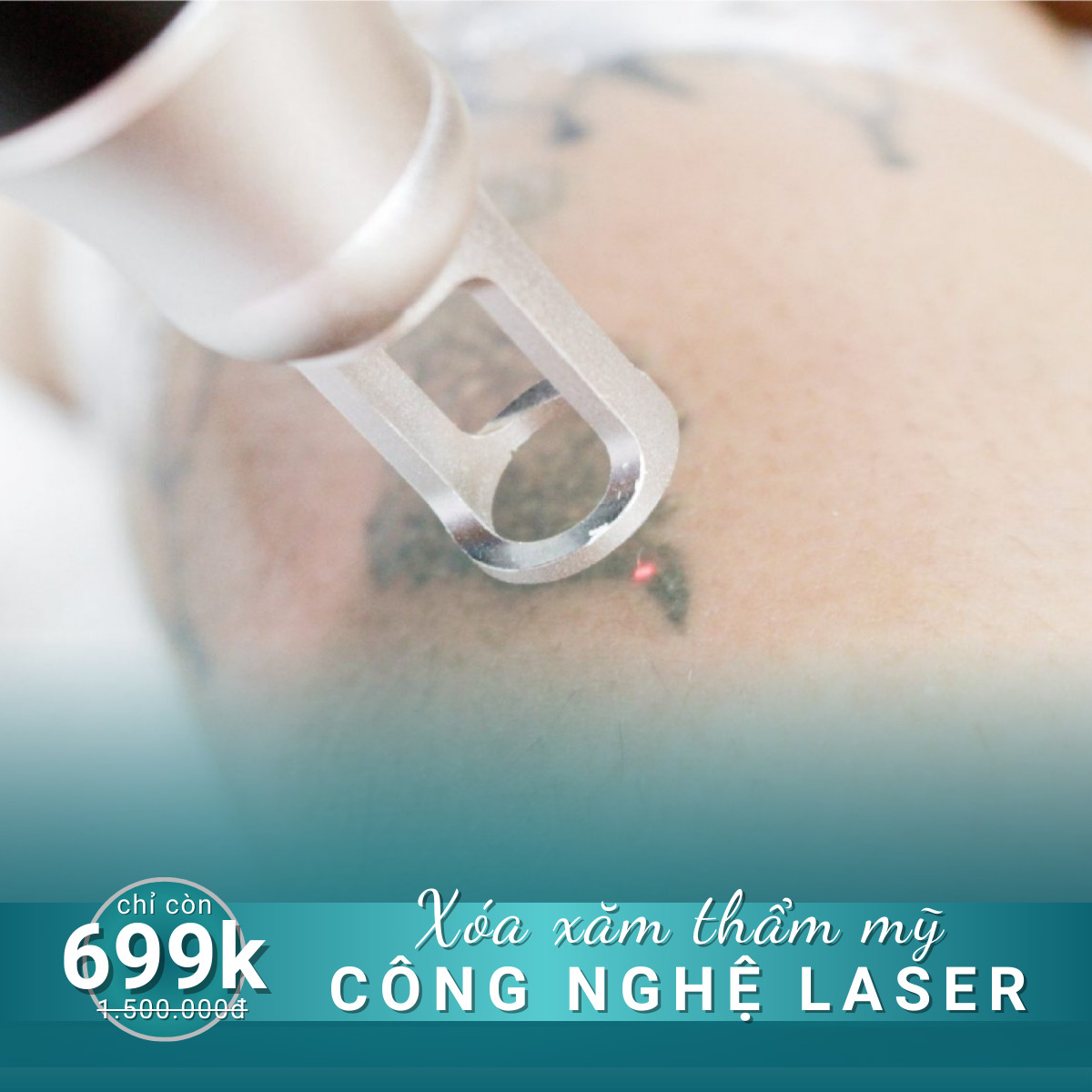 dich vu xoa xam tham my