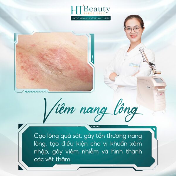 viem nang long