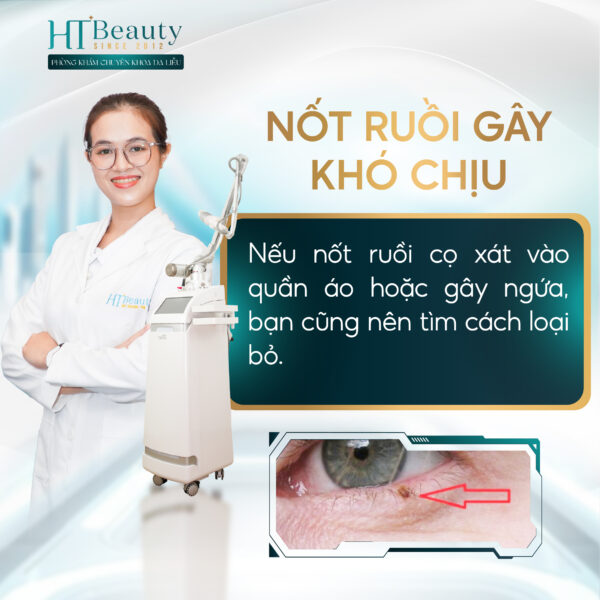 Co nen dot not ruoi hay khong 04 04 1