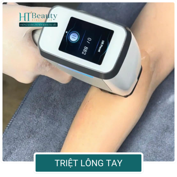 triet long tay
