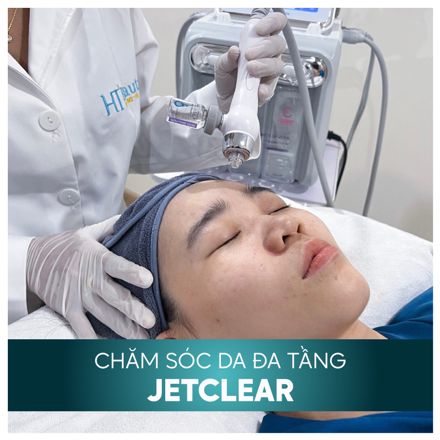 DICH VU JETCLEAR