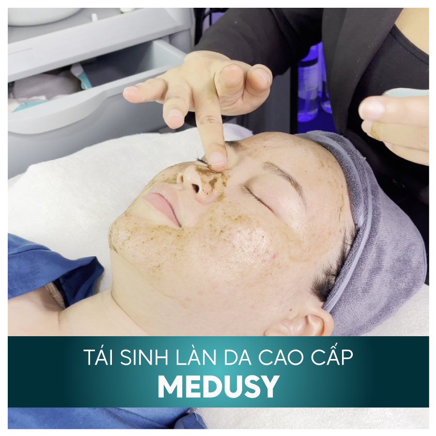 DICH VU MEDUSY