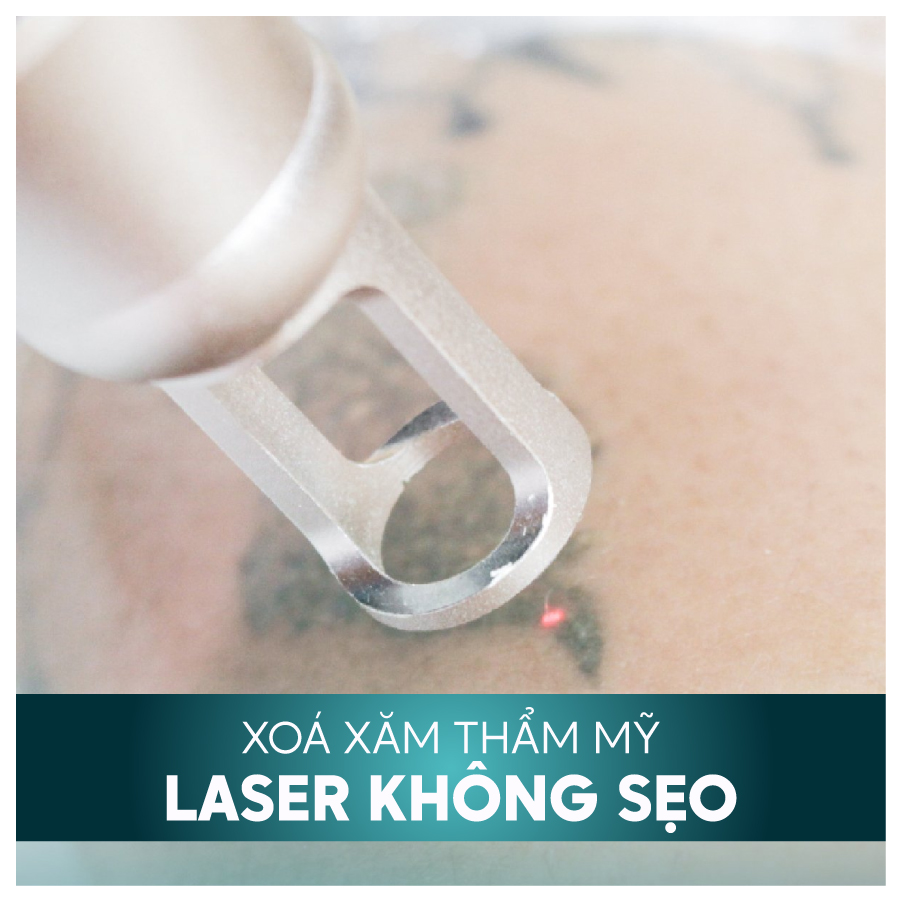 DICH VU XOA XAM