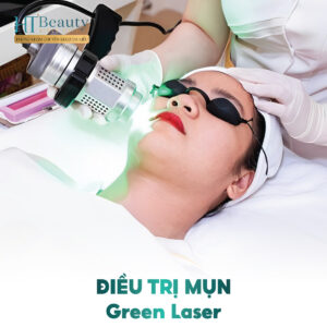 Trị Mụn Công Nghệ Green Laser