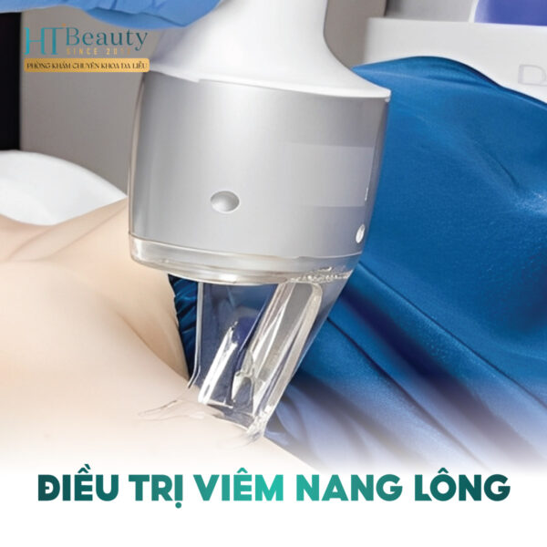 dieu tri viem nang long 1