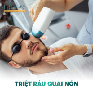 Triệt Râu Quai Nón – Gương Mặt Sáng Sạch, Lịch Lãm Mỗi Ngày