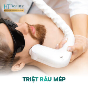 Triệt Mép – Da sáng mịn, tự tin gần gũi