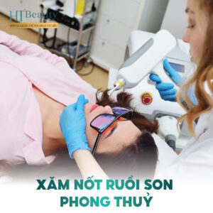 Xăm Nốt Ruồi Son