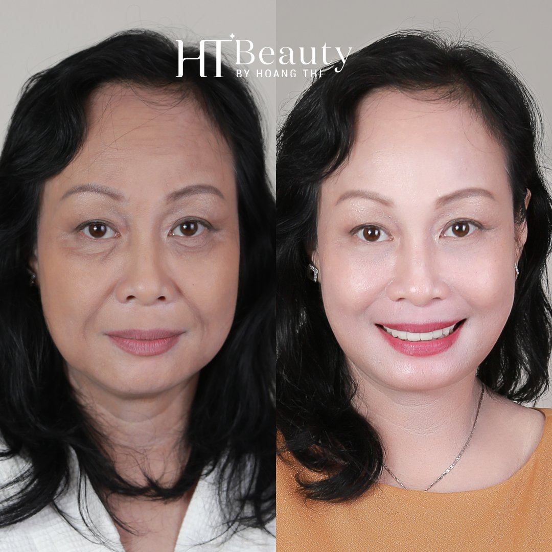 HINH TRUOC SAU NANG CO