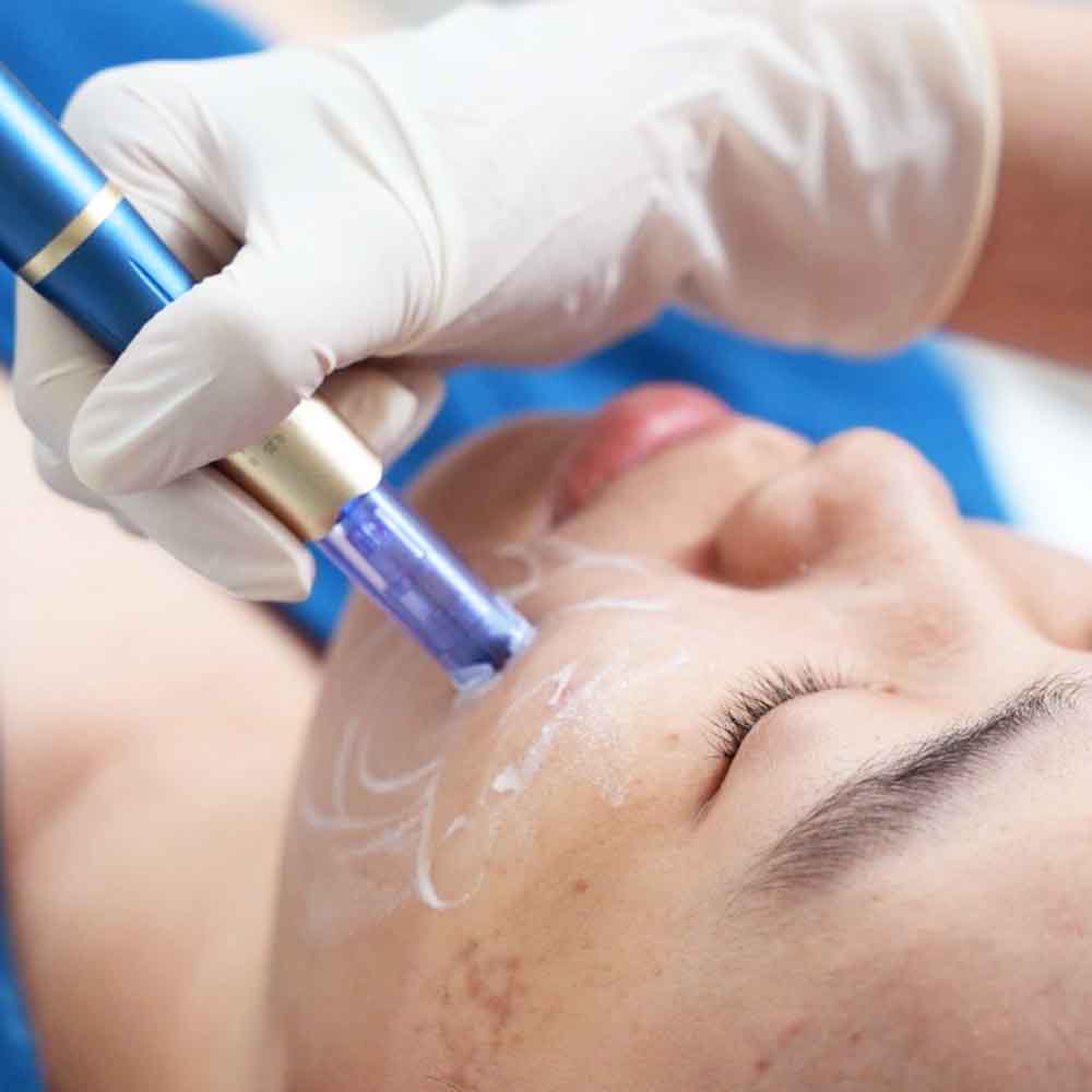 hinh dai dien menu dvArtboard 1 copy 11