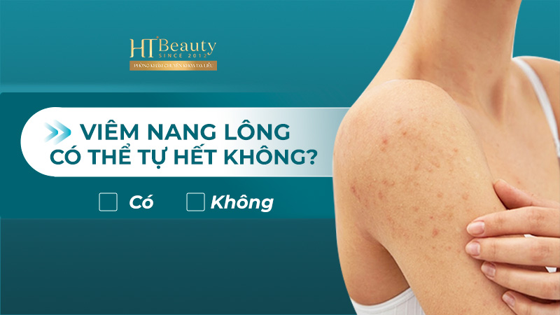 Viêm nang lông có tự hết không?