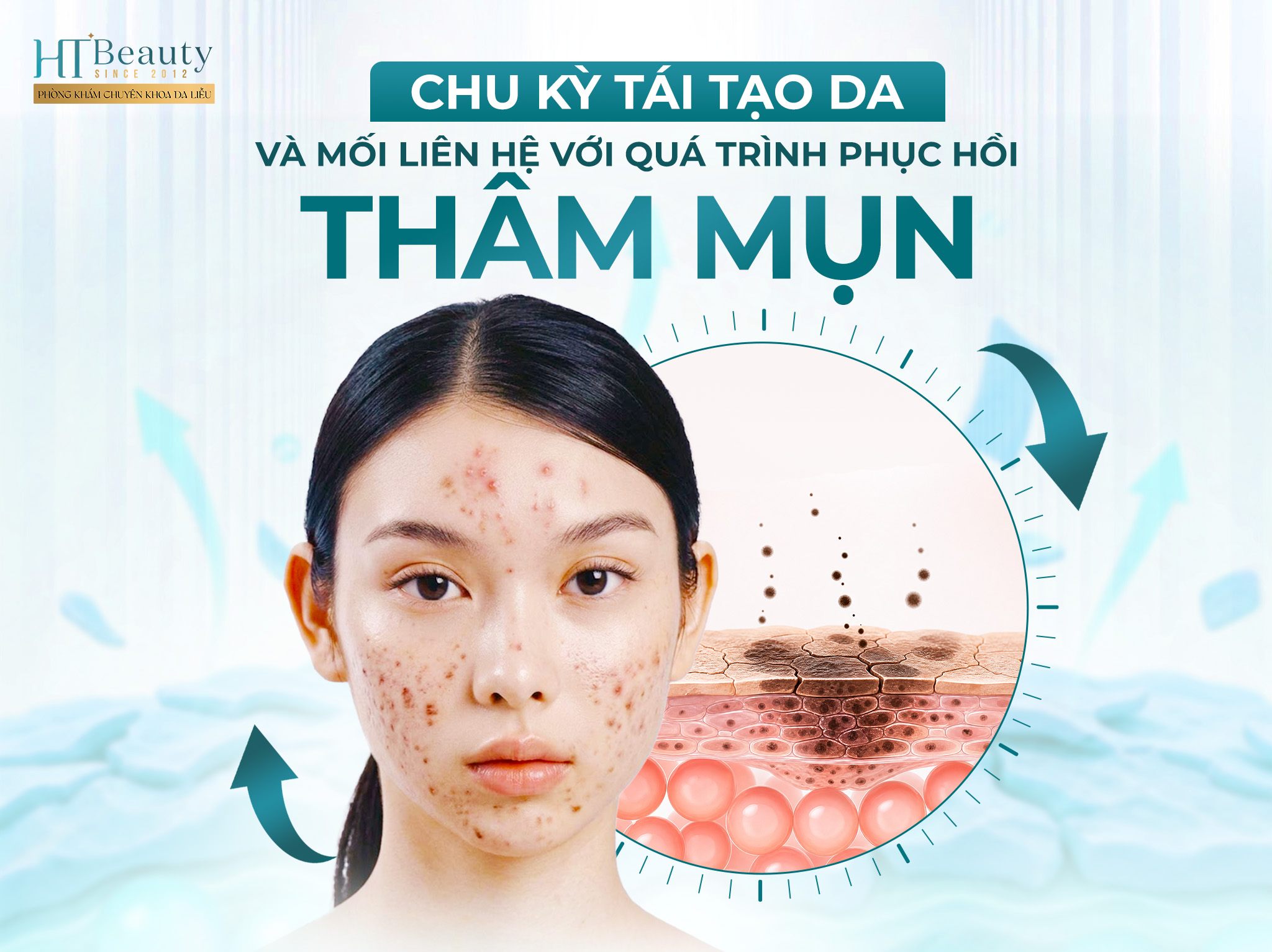 Chu kỳ tái tạo da và mối liên hệ với quá trình phục hồi thâm mụn