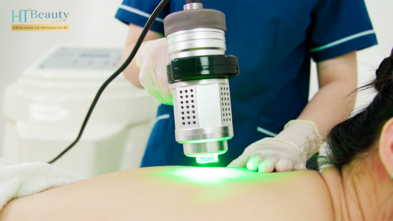 Điều trị viêm nang lông Fusion Therapy