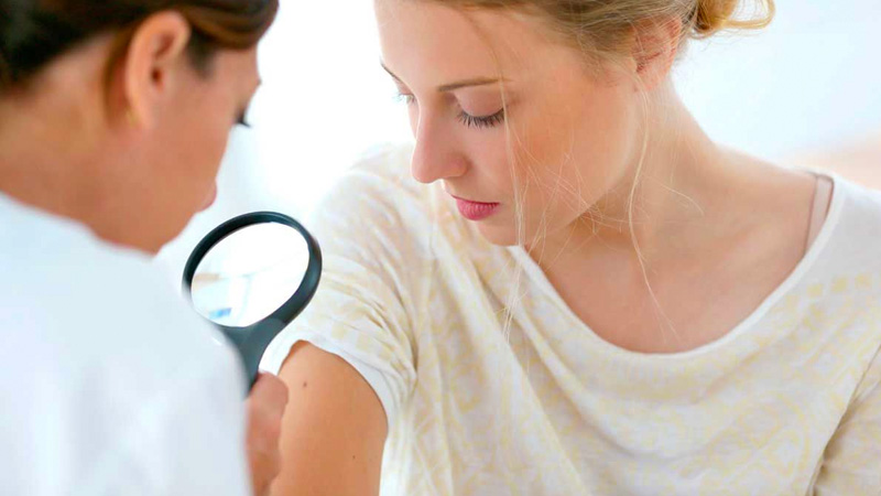 Viêm nang lông nên được phát hiện và điều trị sớm