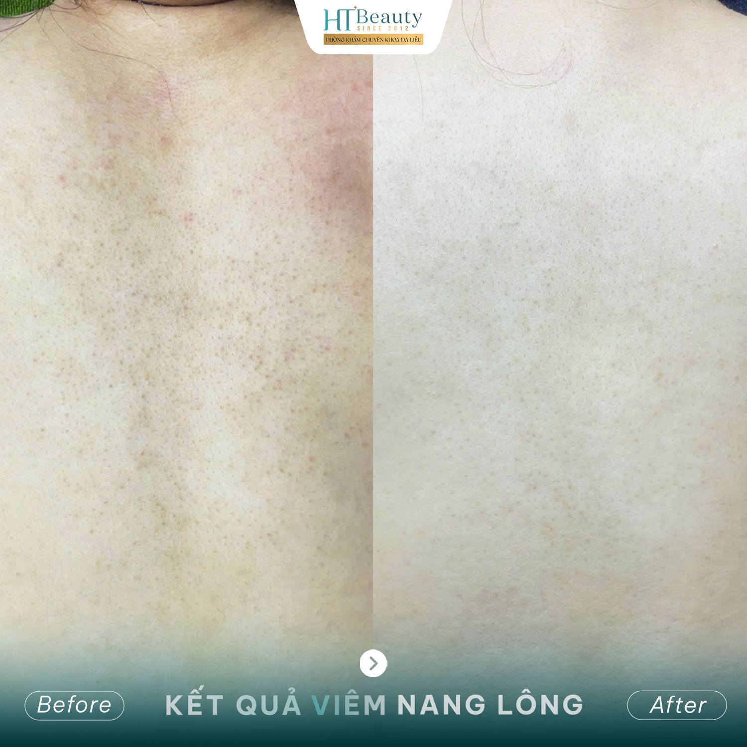 Kết quả điều trị 1