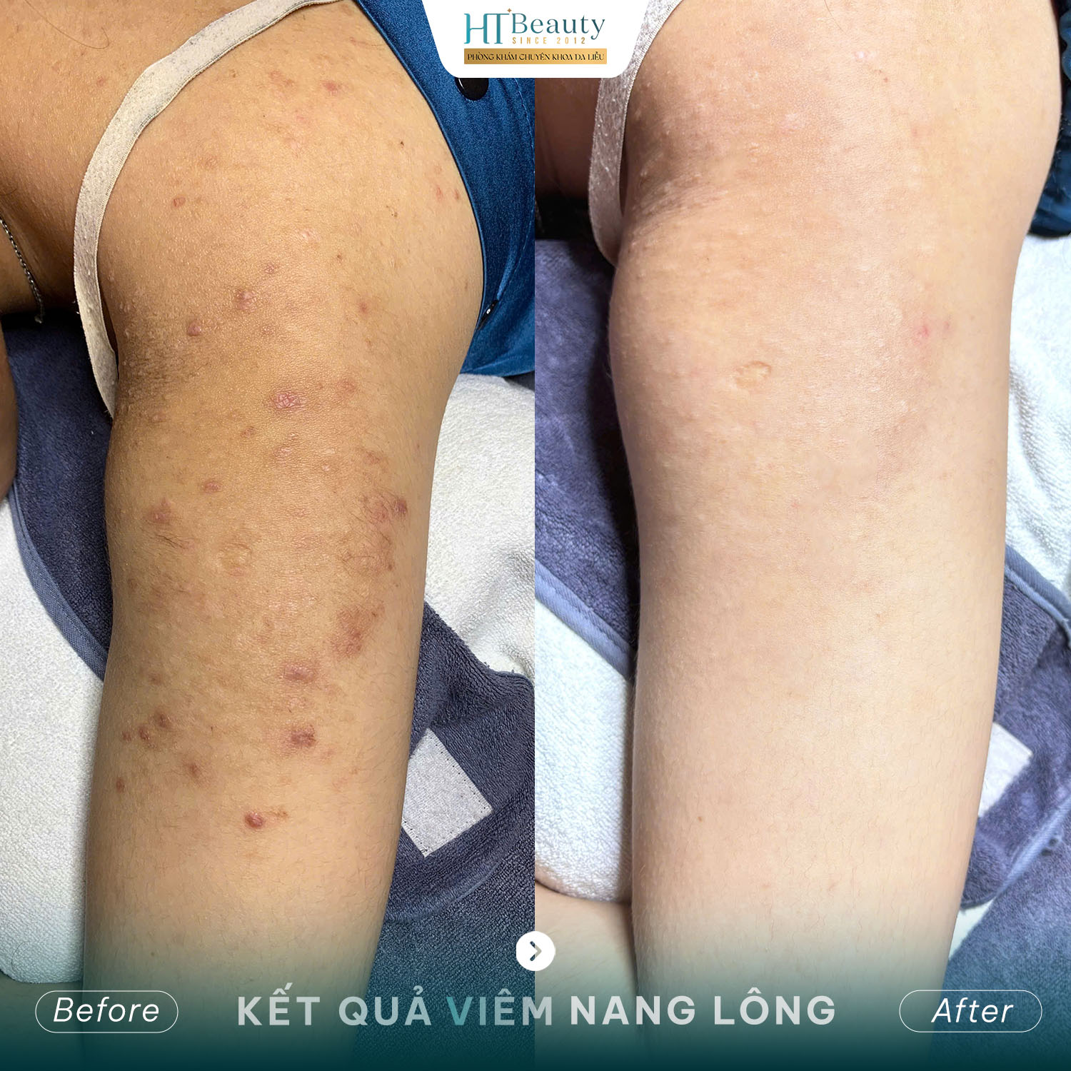 Kết quả điều trị 5