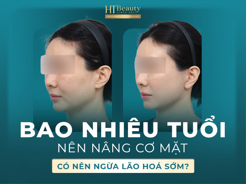 Bao nhiêu tuổi nên nâng cơ mặt