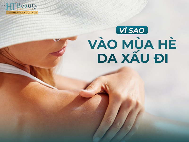 Vì sao mùa hè da xấu đi?