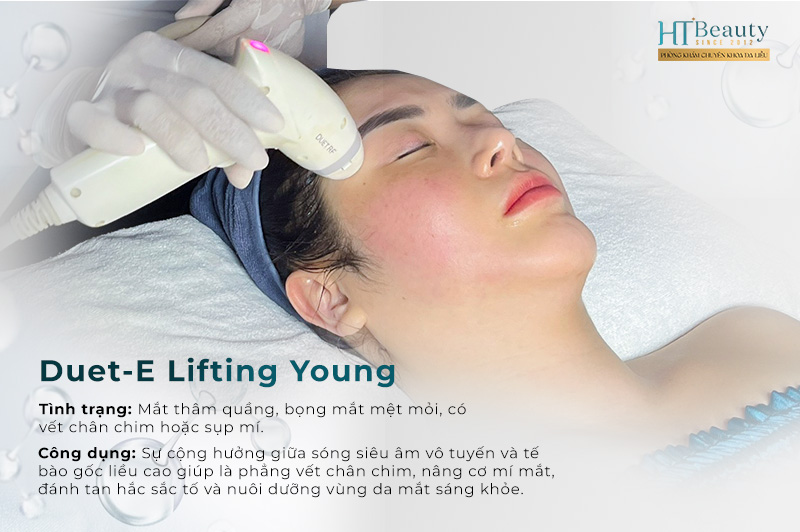 Xoá nhăn vùng mắt Duet-E Lifting Young