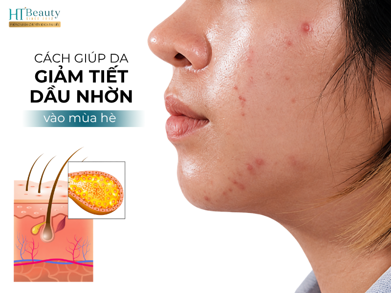 Cách giúp da giảm tiết dầu nhờn vào mùa hè