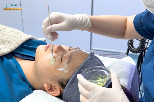 Cách giúp da giảm tiết dầu nhờn vào mùa hè