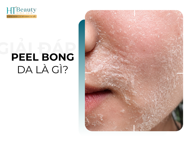 Peel bong da là gì