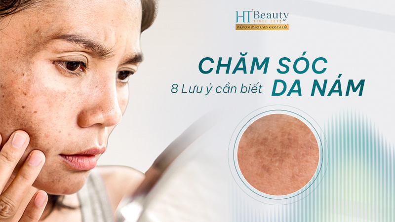 8 Lưu ý chăm sóc da nám tại nhà