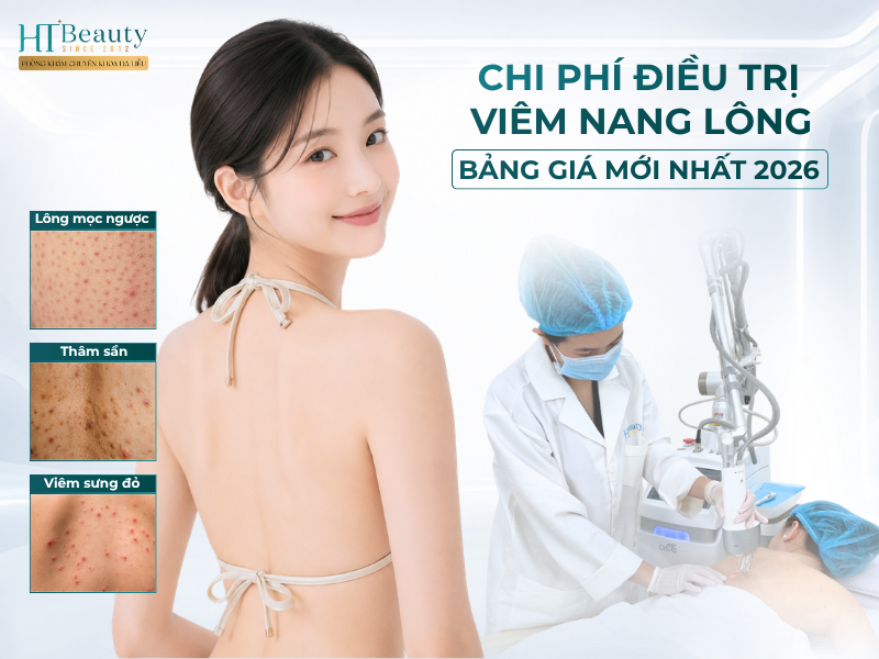 Chi phi dieu tri viem nang long Bang gia moi nhat 2026