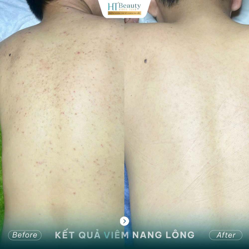 Kết quả điều trị 2