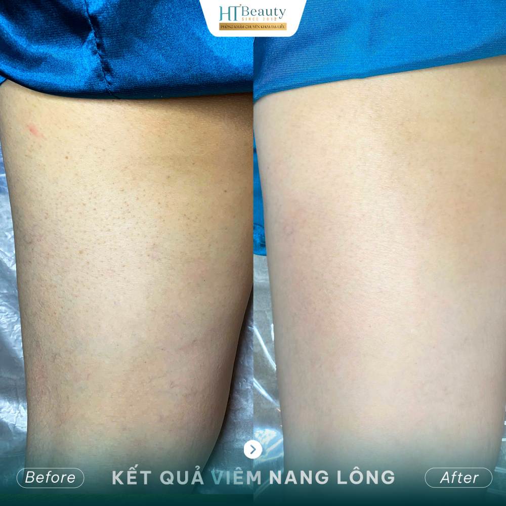 Kết quả điều trị 5