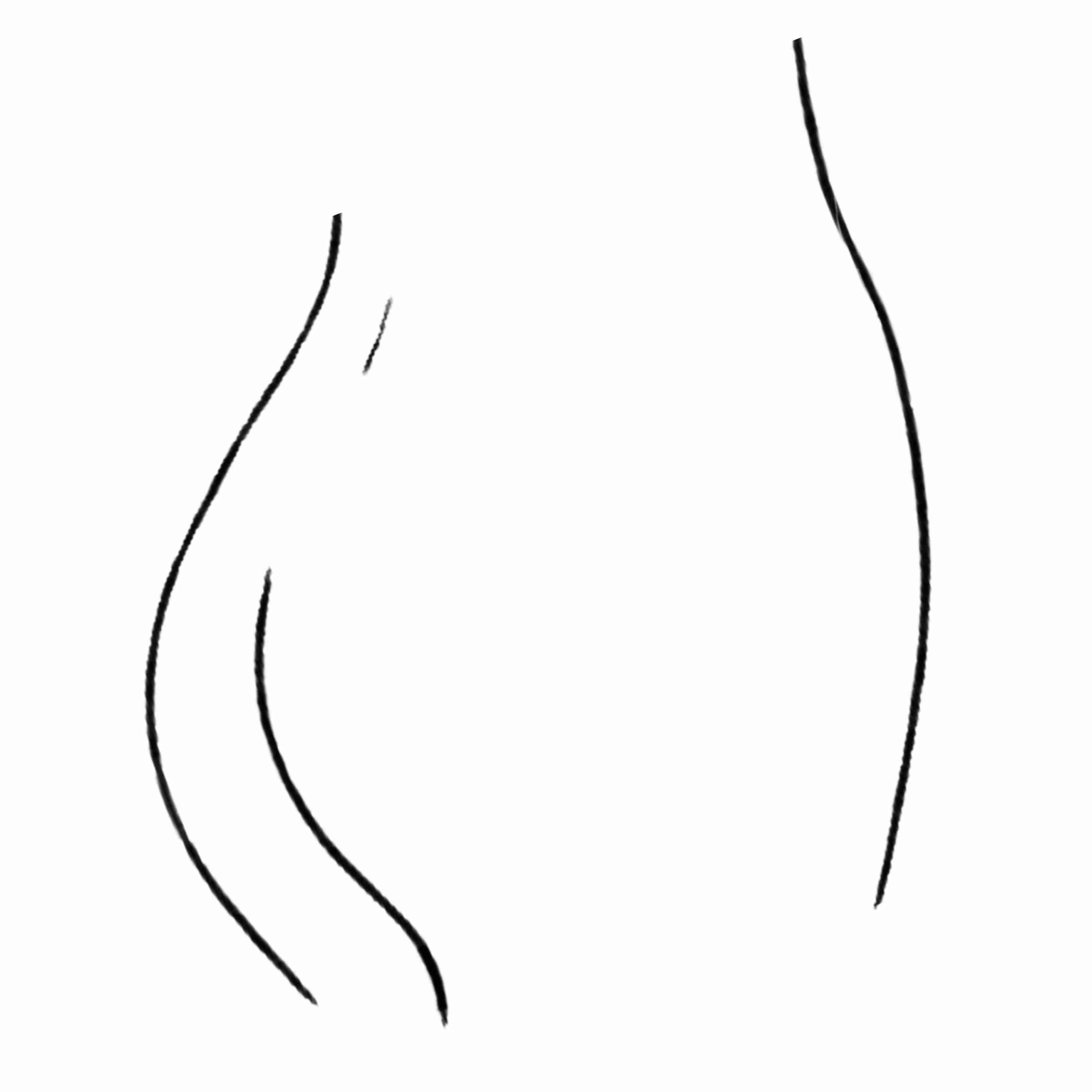 Các vị trí thường gặp viêm nang lông