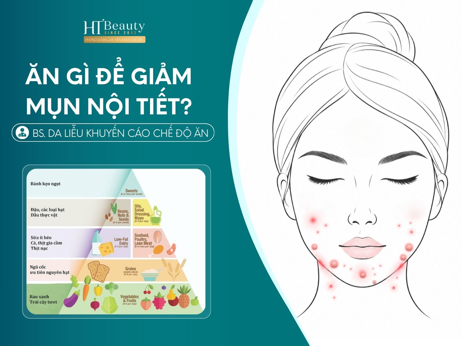 Ăn gì để giảm mụn nội tiết?