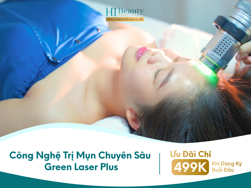 Công nghệ điều trị mụn Green Laser Plus