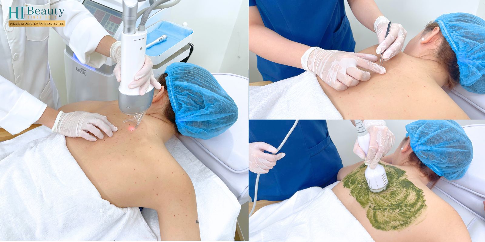 Phòng khám Chuyên khoa Da liễu HT Beauty là địa chỉ điều trị da uy tín