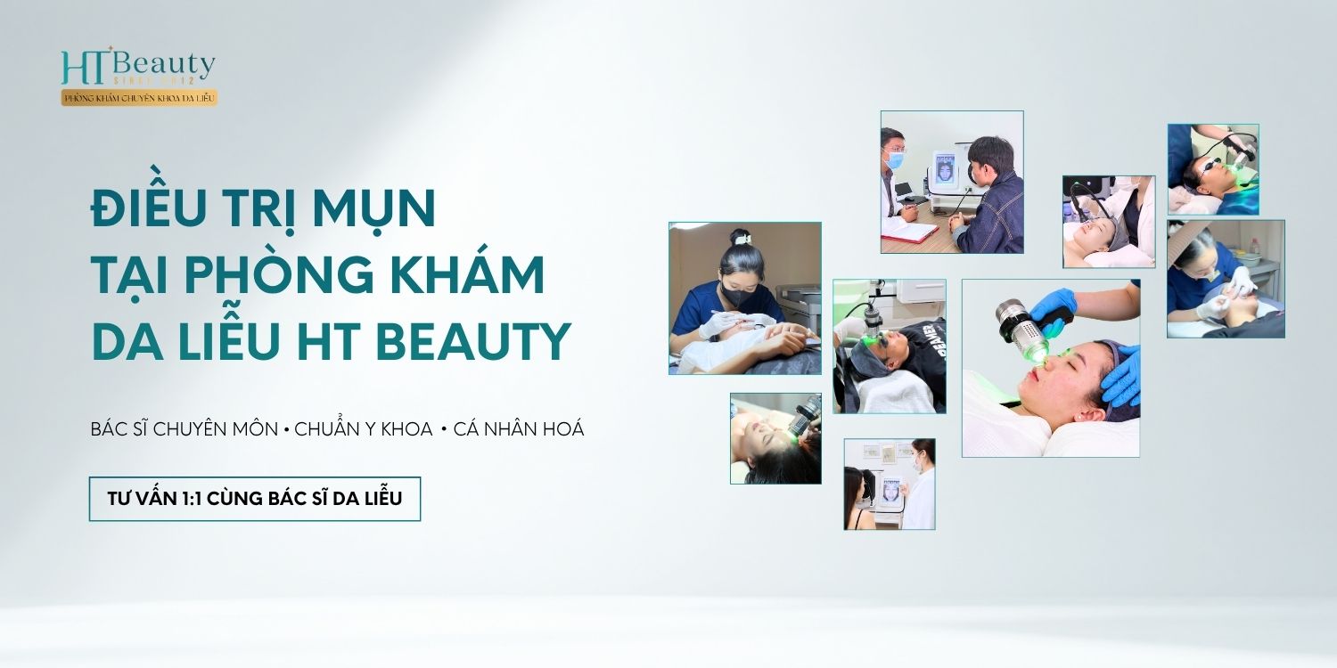 Điều trị mụn chuẩn y khoa tại Phòng khám Chuyên khoa Da liễu HT Beauty