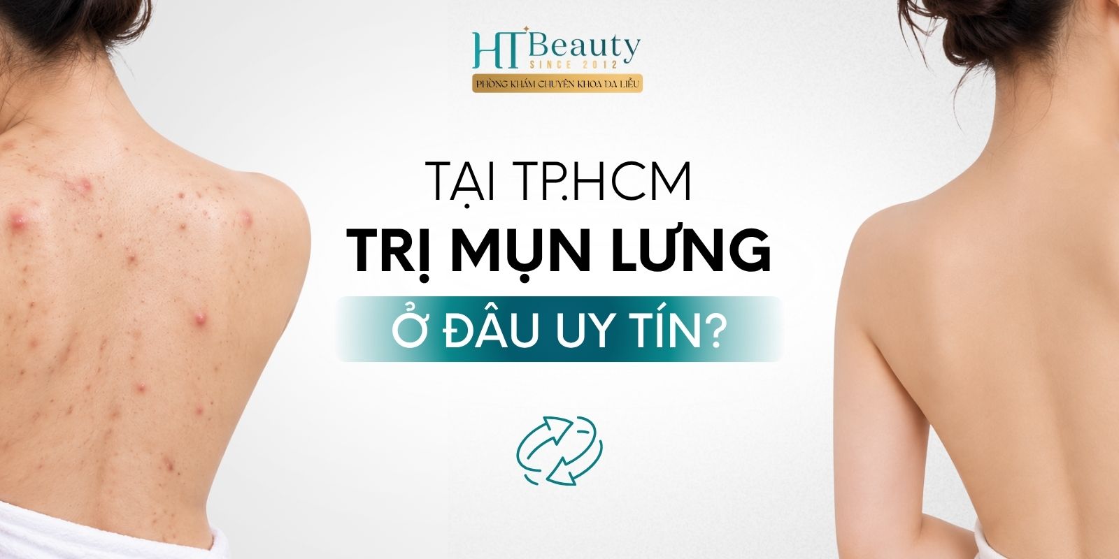 Trị mụn lưng ở đâu uy tín tại TP.HCM?