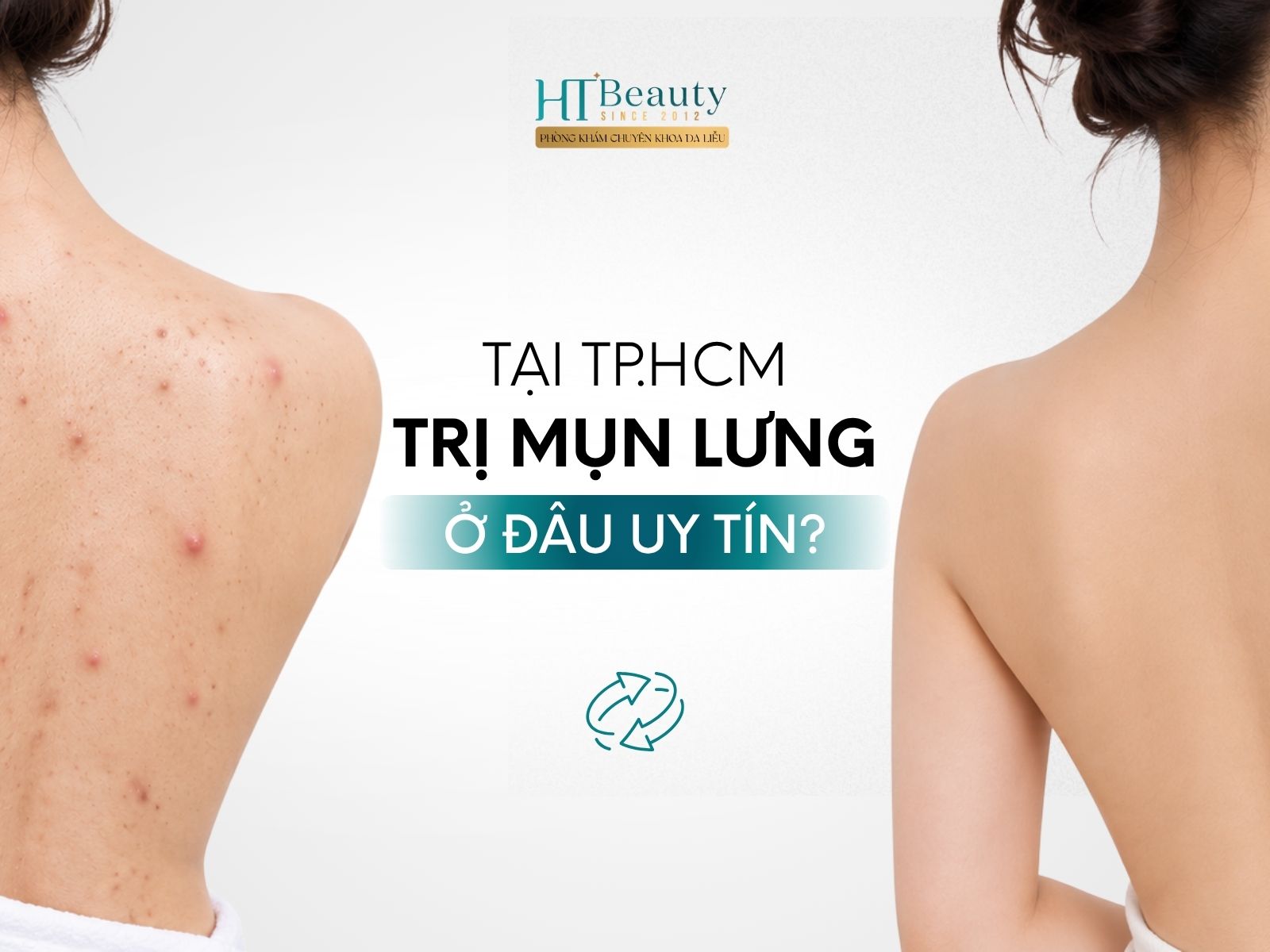 Trị mụn lưng ở đâu uy tín tại TP.HCM?